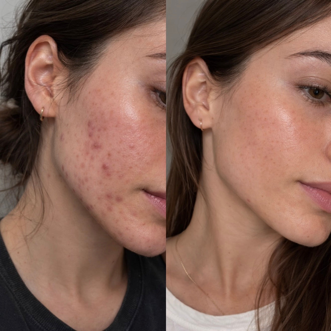 Post-Cleanse Recovery: The Power of Amino Acids